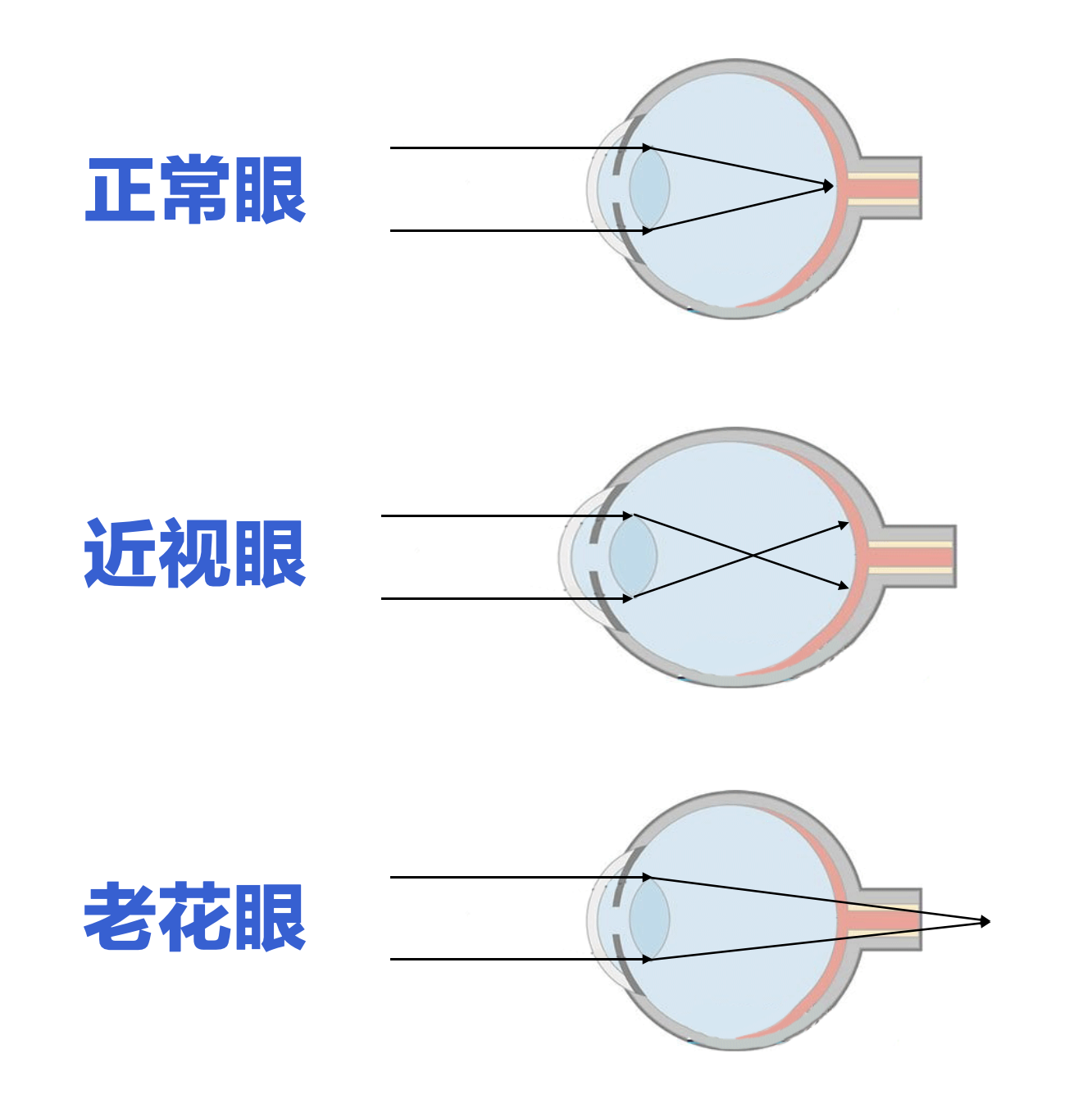 多焦鏡